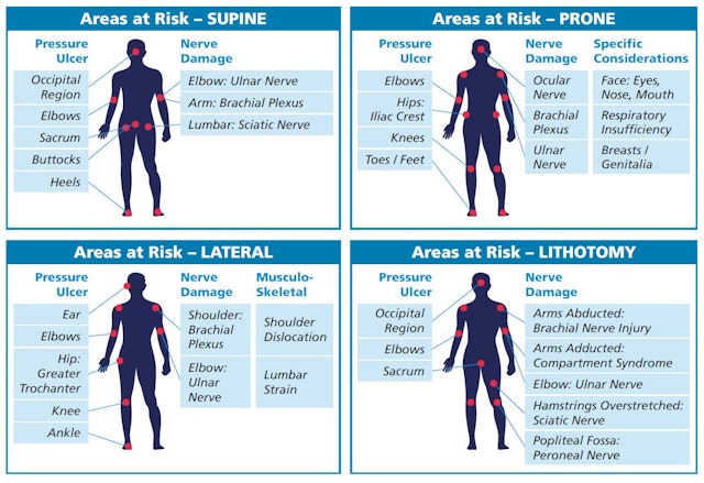 The pressure to relieve pressure | AneticAid